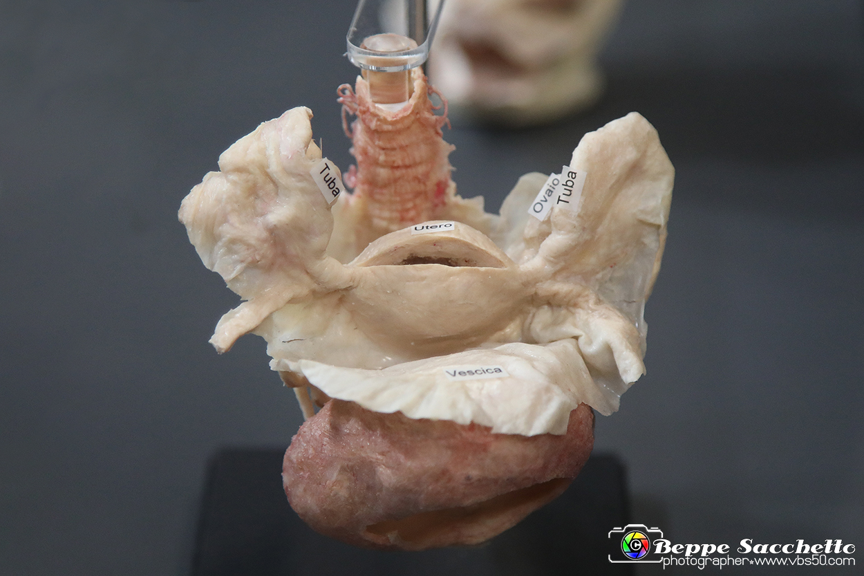 VBS_2561 - Apparato riproduttivo femminile - Mostra Body Worlds.jpg
